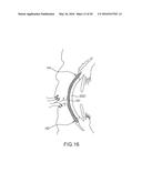 DETECTION APPARATUS AND METHOD diagram and image