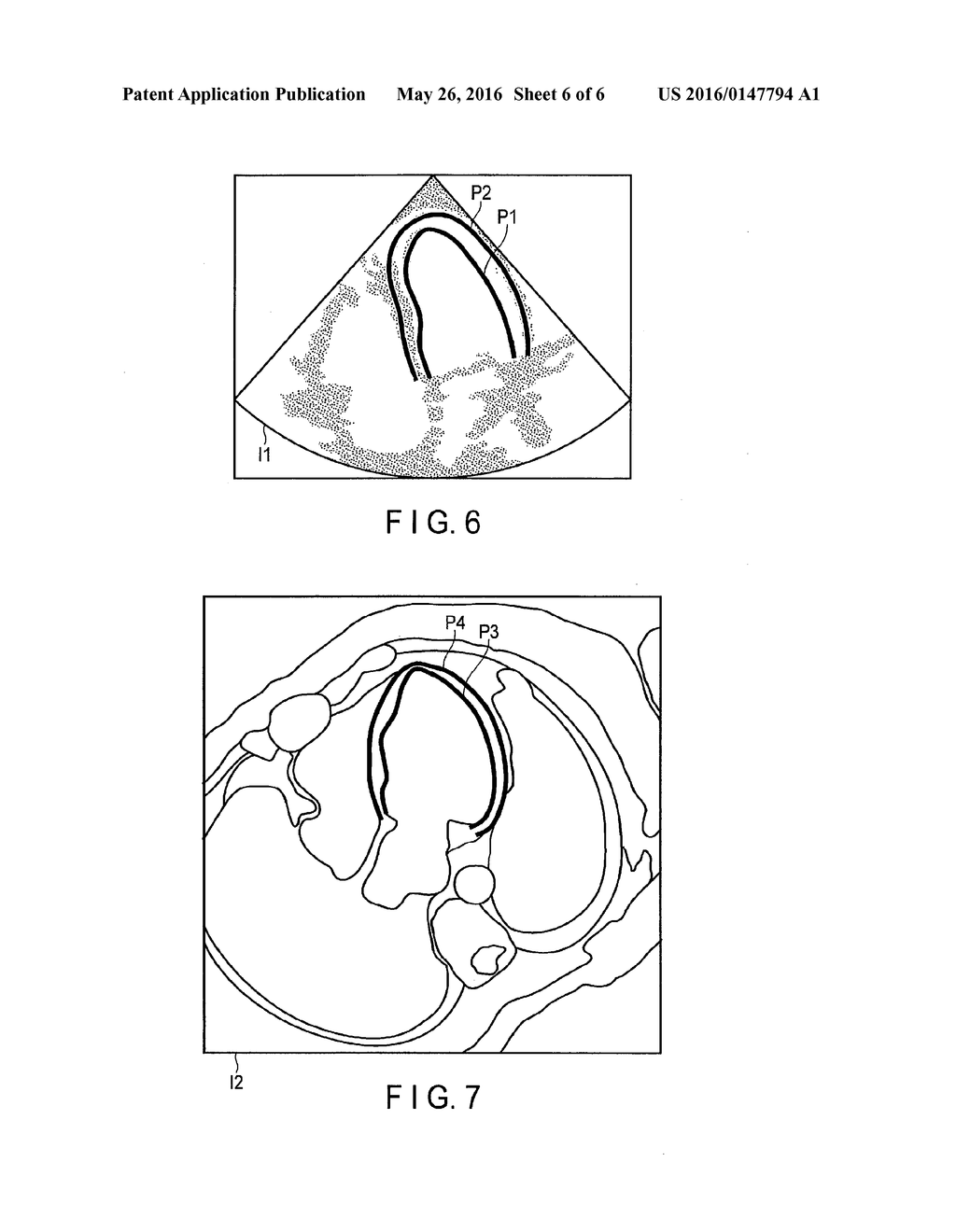 ULTRASONIC DIAGNOSTIC APPARATUS, MEDICAL IMAGE PROCESSING APPARATUS, AND     MEDICAL IMAGE PROCESSING METHOD - diagram, schematic, and image 07