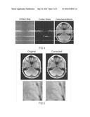 METHOD, COMPUTER READABLE MEDIUM AND MRI APPARATUS FOR PERFORMING     PHASE-ENCODE GHOSTING DETECTION AND MITIGATION IN MRI diagram and image