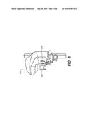 METHOD FOR PRODUCING TEETH SURFACE FROM X-RAY SCAN OF A NEGATIVE     IMPRESSION diagram and image