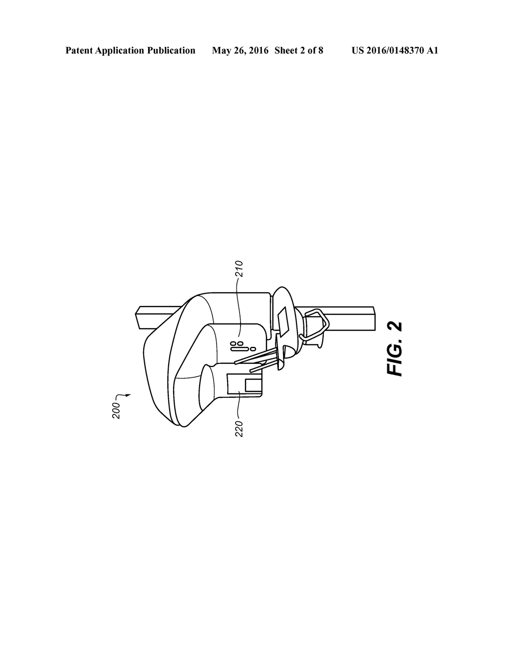 METHOD FOR PRODUCING TEETH SURFACE FROM X-RAY SCAN OF A NEGATIVE     IMPRESSION - diagram, schematic, and image 03