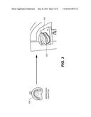 METHOD FOR PRODUCING TEETH SURFACE FROM X-RAY SCAN OF A NEGATIVE     IMPRESSION diagram and image