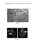 SYNTHETIC DATA-DRIVEN HEMODYNAMIC DETERMINATION IN MEDICAL IMAGING diagram and image