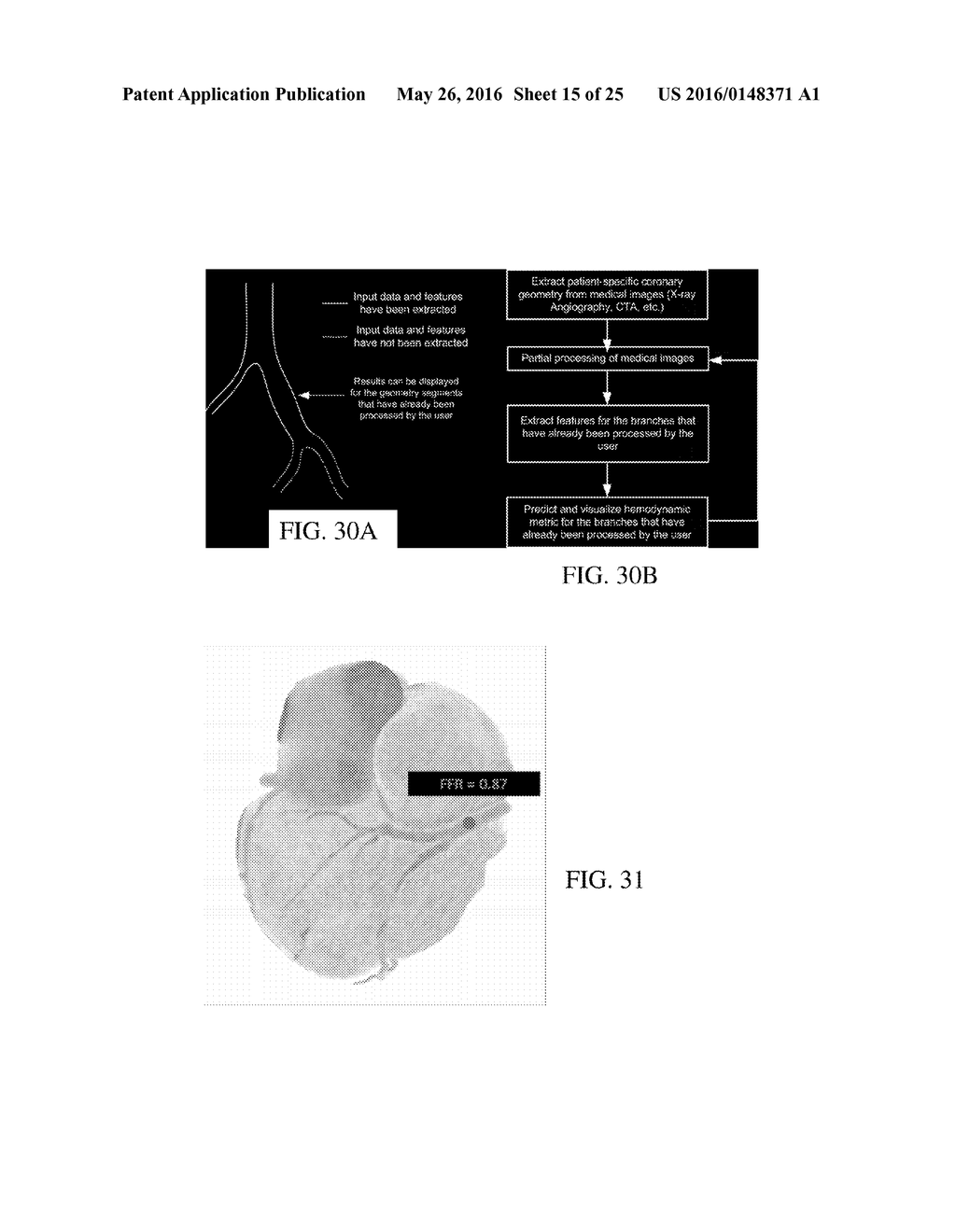 SYNTHETIC DATA-DRIVEN HEMODYNAMIC DETERMINATION IN MEDICAL IMAGING - diagram, schematic, and image 16
