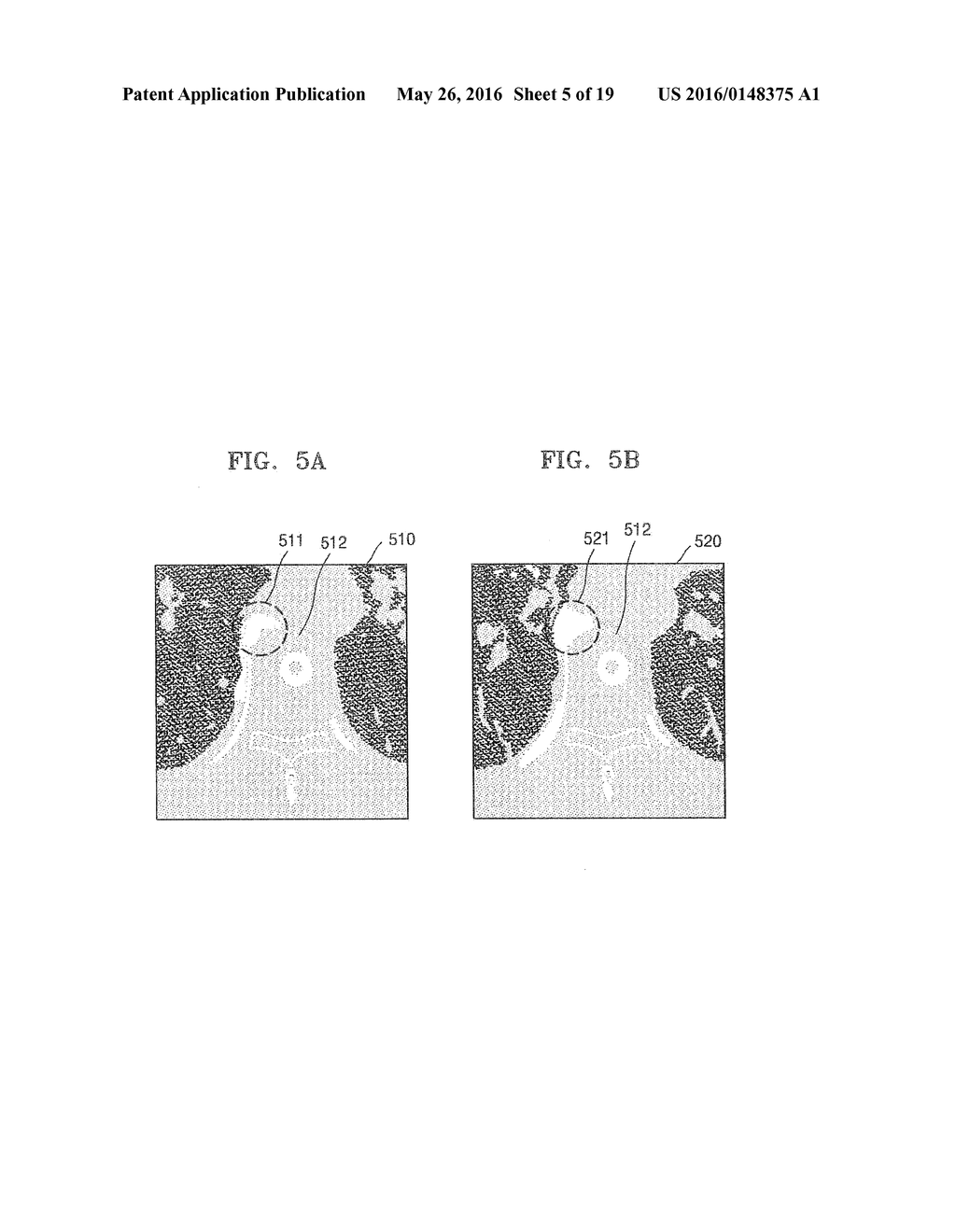 Method and Apparatus for Processing Medical Image - diagram, schematic, and image 06