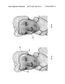 TECHNIQUES FOR PROCESSING RECONSTRUCTED THREE-DIMENSIONAL IMAGE DATA diagram and image