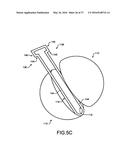 NUCLEAR FISSION IGNITER diagram and image