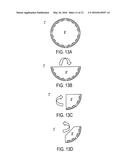 Foldable Radome diagram and image