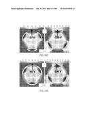 Robust Triboelectric Nanogenerator Based On Rolling Electrification diagram and image