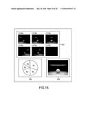 IMAGE PROCESSING APPARATUS AND METHOD, AND PROGRAM diagram and image