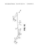 Bone-conduction Anvil and Diaphragm diagram and image