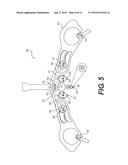 ELECTRODE ARRAY AND METHOD OF PLACEMENT diagram and image