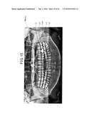 PANORAMIC IMAGE CAPTURING DEVICE, AND IMAGE-BASED DIAGNOSTIC METHOD USED     THEREIN diagram and image