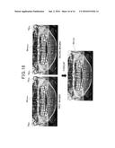 PANORAMIC IMAGE CAPTURING DEVICE, AND IMAGE-BASED DIAGNOSTIC METHOD USED     THEREIN diagram and image