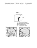 X-RAY DIAGNOSTIC APPARATUS diagram and image