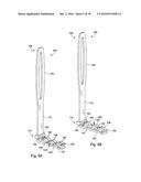 Surgical Retractor diagram and image