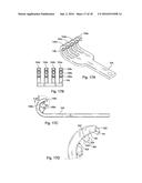 Surgical Retractor diagram and image