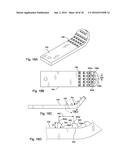 Surgical Retractor diagram and image