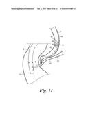 BODY CAVITY FOREIGN MATTER CAPTURE INSTRUMENT diagram and image