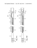 BODY CAVITY FOREIGN MATTER CAPTURE INSTRUMENT diagram and image