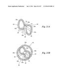 BODY CAVITY FOREIGN MATTER CAPTURE INSTRUMENT diagram and image