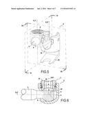 ORTHOPAEDIC DEVICE AND METHODS FOR ITS PRE-ASSEMBLY AND ASSEMBLY diagram and image