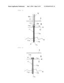 MEDICAL SCREW, AND EXTRACTION JIG FOR MEDICAL SCREW diagram and image