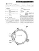 Apparatus For The Treatment of Cataract diagram and image