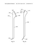 Apparatus For The Treatment of Cataract diagram and image