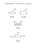 Apparatus For The Treatment of Cataract diagram and image