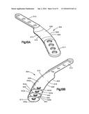 Implants/Procedures Related to Tibial Tuberosity Advancement diagram and image