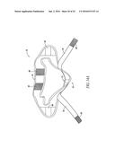 PORTABLE CERVICAL TRACTION DEVICE WITH SUSPENSION HEAD HALTER diagram and image