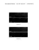 Compositions and Methods for Treating Neuropsychiatric Disorders Using an     Endothelin-B Receptor Agonist diagram and image