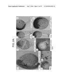 LEUKOLECTINS AND USES THEREOF diagram and image