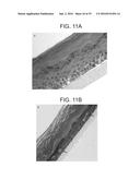 LEUKOLECTINS AND USES THEREOF diagram and image