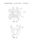 PATIENT INTERFACE AND ASPECTS THEREOF diagram and image