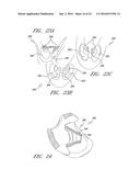 PATIENT INTERFACE AND ASPECTS THEREOF diagram and image