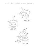 PATIENT INTERFACE AND ASPECTS THEREOF diagram and image