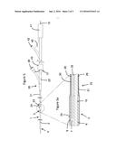 CATHETER SYSTEM FOR DELIVERY OF A URETERAL CATHETER diagram and image