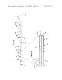 CATHETER SYSTEM FOR DELIVERY OF A URETERAL CATHETER diagram and image