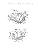 Golf Club Heads or Other Ball Striking Devices Having Distributed Impact     Response diagram and image