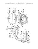 Golf Club Heads or Other Ball Striking Devices Having Distributed Impact     Response diagram and image