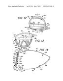 Golf Club Heads or Other Ball Striking Devices Having Distributed Impact     Response diagram and image