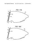 Golf Club Heads or Other Ball Striking Devices Having Distributed Impact     Response diagram and image