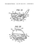 Golf Club Heads or Other Ball Striking Devices Having Distributed Impact     Response diagram and image