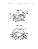 Golf Club Heads or Other Ball Striking Devices Having Distributed Impact     Response diagram and image