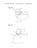 TRIGGER ATTACHMENT AND METHOD FOR VIDEOGAME CONTROLLERS diagram and image