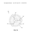 INJECTION MOLDING DEVICE FOR THICK LENSES AND METHOD OF MANUFACTURING diagram and image