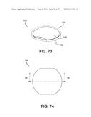 INJECTION MOLDING DEVICE FOR THICK LENSES AND METHOD OF MANUFACTURING diagram and image