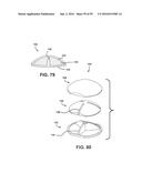 INJECTION MOLDING DEVICE FOR THICK LENSES AND METHOD OF MANUFACTURING diagram and image